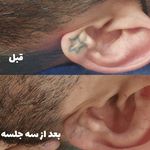 مر کز تخصصی لیزر وکلینیک زیبایی باران