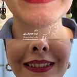 مطب زیبایی آرا