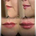 کلینیک زیبایی و پوست و مو رومنس
