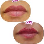 کلینیک لیزر وزیبایی لوانا