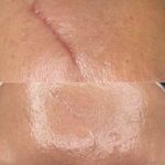 خدمات تخصصی تتو و کاموفلاژ بانوان- تارا