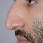 کلینیک زیبایی الماس کاملا اقساطی