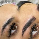 میکروبلیدینگ و فیبروز