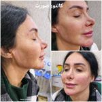 کلینیک زیبایی و لیزر مو گندم شرق تهران