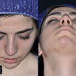 فتوگرافی پزشکی مظلومی