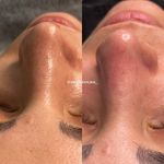 آموزشگاه و مرکز تخصصی پوست و موی قم