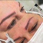 میکروبلیدینگ و میکروپیگمنتیشن ابرو