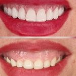 کلینیک زیبایی الماس کاملا اقساطی