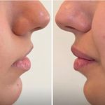مطب زیبایی آرا