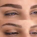مرکز تخصصی فیبروز ابرو مژگان خناری