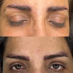 میکروکیماسی( میکروابرو چشم لب،ریمو)
