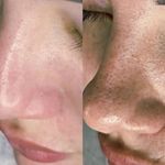 مرکز تخصصی فیشیال حانیه سیمابی
