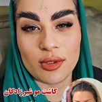 کلینیک کاشت مو مریم شیرزادگان