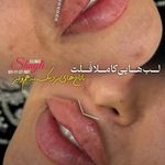 کلینیک زیبایی شایلی
