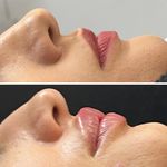 کلینیک زیبایی و جوانسازی پوست و مو الین