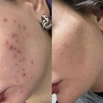 مژگان اسکین کرMojgan skincare