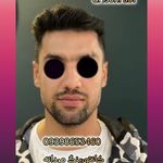 مطب پوست ،مو و لیزر یسنا طب