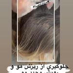 کلینیک پوست و مو و لیزر نیلوفر آبی