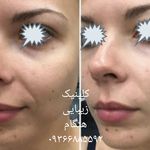 کلینیک زیبایی نامیرا