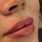 مرکز پوست و زیبایی ارمغان