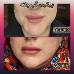 مطب پوست ،مو و لیزر یسنا طب