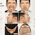 رادیولوژی رخ