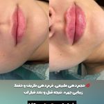 مرکز لیزر و کلینیک زیبایی پریفا