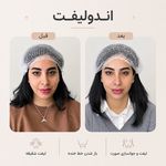 مرکز لیزر ،پوست و زیبایی کندی بیوتی