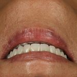 دندانپزشکی دکتر مریم ولائی