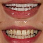 دندانپزشکی دکتر مریم ولائی