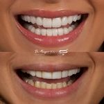 دندانپزشکی دکتر مریم ولائی