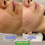 خدمات فیشیال و پاکسازی پوست