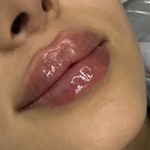 کلینیک زیبایی و لاغری الین