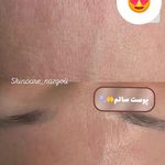 فیشال پوست نازگل