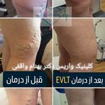کلینیک تخصصی درمان واریس دکتر واقفی