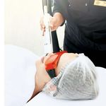 آرامش لیزر
