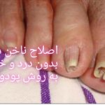 پدیکور و پودولوژیSD