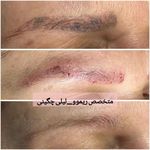 آرایش دائم، میکروپیگمنت، شید لب، خط چشم