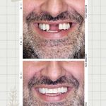 مرکز دندانپزشکی دیجیتال بابل ایمپلنت