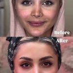 کلینیک پوست،مو،زیبایی و مرکز لیزر نوژا