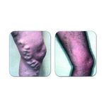 دکتر آرش توفیق جراح و متخصص عروق و واریس