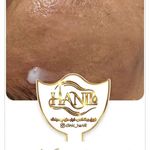 کلینیک هانیل | فیلر و بوتاکس شرق
