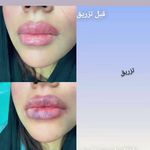 کلینیک زیبایی -لاغری