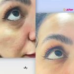کلینیک زیبایی -لاغری