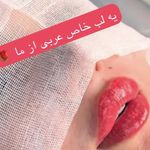 کلینیک زیبایی، پوست و مو نچرال بیوتی