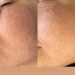خدمات تخصصی فیشال و پاکسازی