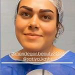 کلینیک زیبایی و کاشت مو و ابرو ساتیا