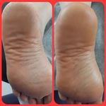 کاشت ناخن پودر و ژل