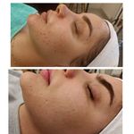 پاکسازی و فیشال تخصصی سعیده فتحی