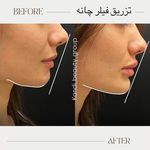 مرکز لیزر ،پوست و زیبایی کندی بیوتی